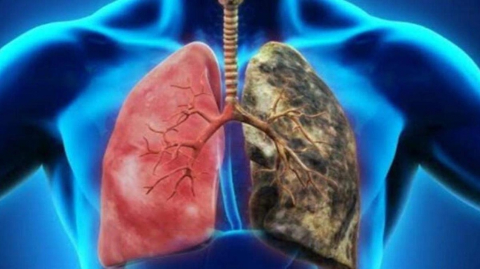 KOAH, ölüm oranı en hızlı artan hastalık