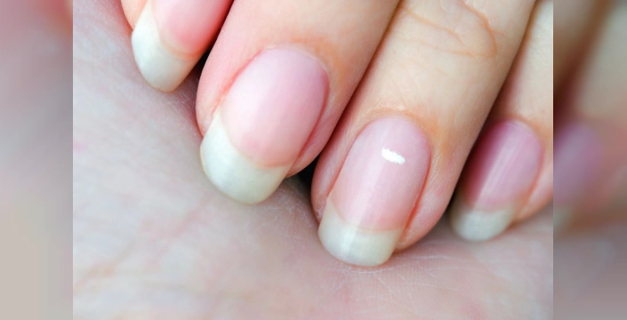 Tırnaklarınız sağlığınızın aynası: Dikkat edilmesi gereken işaretler