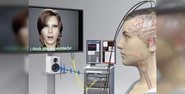 Yapay Zeka Destekli İmplant: Felçli Öğretmen Neredeyse Gerçek Zamanlı Konuşabiliyor