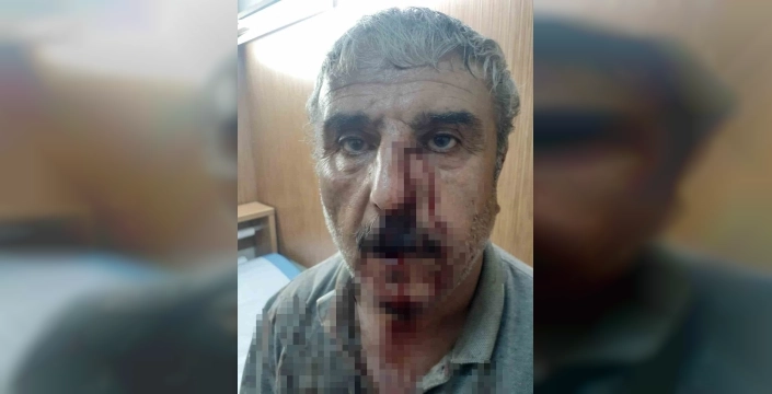 Acıpayam'da tartışma: Emekli öğretmen ile aile hekimi karakolda