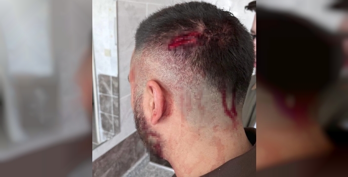 Şanlıurfa'da öğretmene veli saldırısı: Sopayla darbedildi