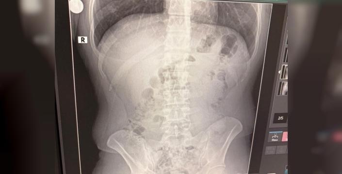 Uşak'ta İran uyruklu 3 şüpheli, 1.5 kilo metamfetaminle yakalandı