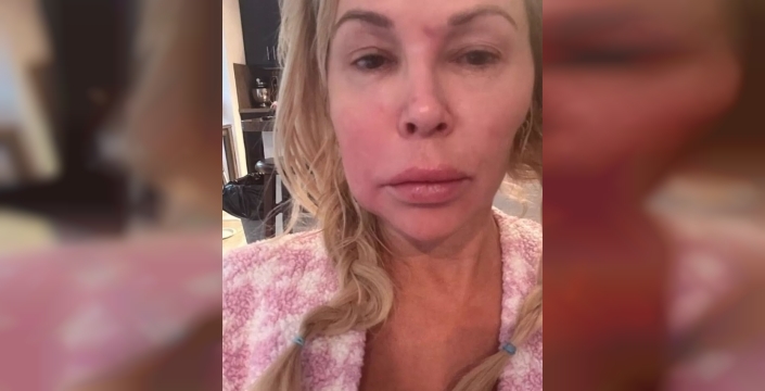 Yüzündeki gizemli hastalığa 130 bin dolar harcadı, sonunda teşhis konuldu!