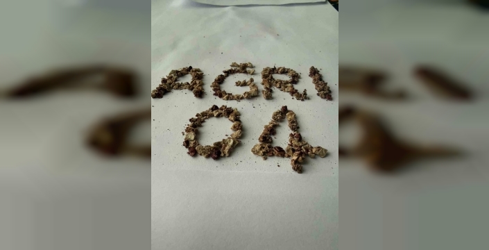 Ağrı'da zorlu taş cerrahisi başarıyla tamamlandı