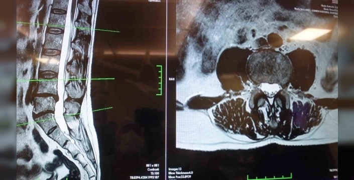 Prof. Dr. Erol: Mekanik bel ağrıları bel fıtığından daha yaygın