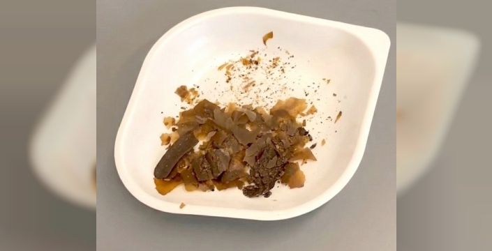 Türk bilim adamları, antik Roma'da dışkı kullanımını kanıtladı