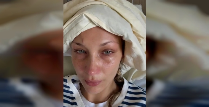 Bella Hadid'den yürek burkan itiraf: Nefes almak bile lüks oldu