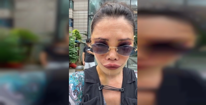 Didem Ceran'dan şok estetik açıklaması: