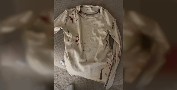 Kedi severken hastanelik olan Reynmen, yaşadığı talihsiz olayı anlattı