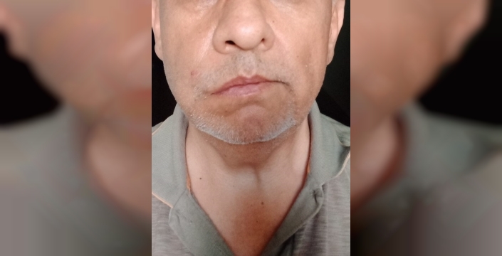 Yolcu otobüsünde doktor ve muavin arasında yumruklu kavga