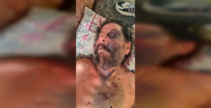 İzmir'de darp edilen adam metruk evde bulundu