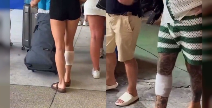 Tayland'da turistlerin sağ bacaklarında dikkat çeken izler