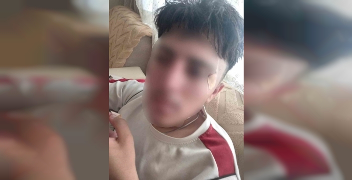 Afyonkarahisar'da öğretmen, öğrencisinin burnunu kırdı
